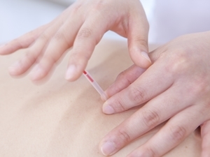 効果重視の施術です